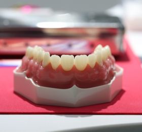 Resina Composta em Dentes Anteriores <br> 3ª Turma